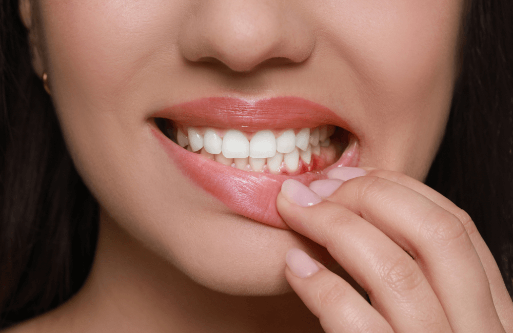 Vaping impact on oral health