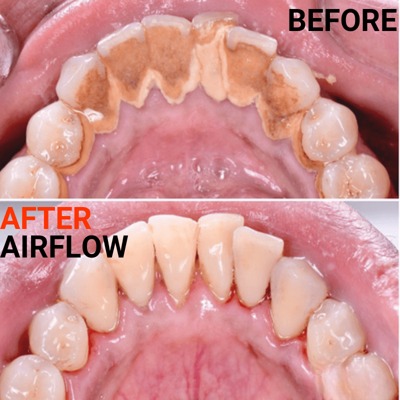 A Preventive Mindset for Lifelong Oral Health