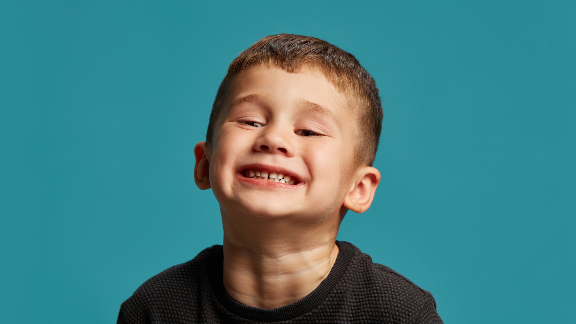 A young boy smiling widely with an open bite posture that can impact early craniofacial development.