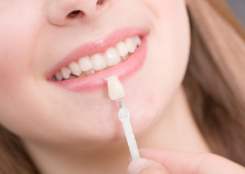 What are porcelain veneers and should you get the cosmetic procedure done?